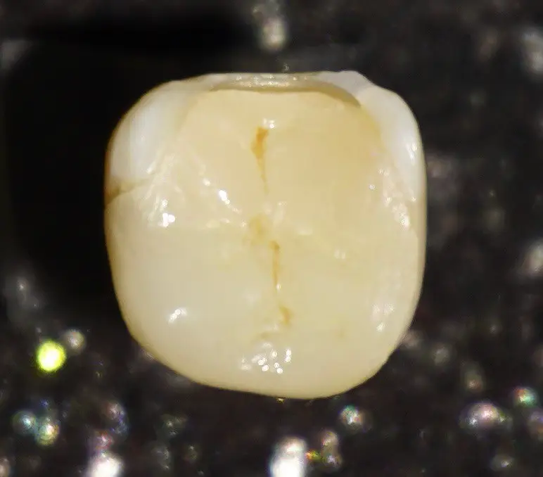 Consejos para prevenir problemas dentales en niños